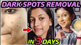 Remove DARK SPOTS NATURALLY in 3 Days 😍 Hyperpigmentation Acne Scars Brown Spots [upl. by Mendie]