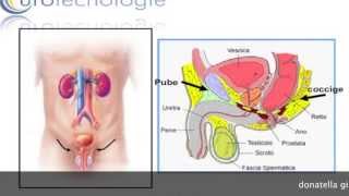 incontinenza dopo prostatectomia [upl. by Haile]