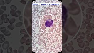 Observe 👀 Basophils Cells Seen In Microscope 🔬 shorts science ytshorts mbbs [upl. by Vladi]