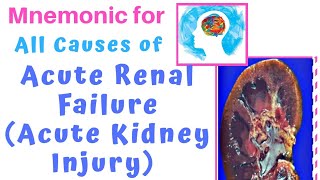 Causes of AKI Mnemonic [upl. by Leur294]