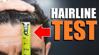 Is Your Hairline SLOWLY Receding Hairline Test Plus 4 BEST Hairstyles to Hide It [upl. by Ronda]