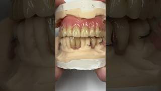 Process Denture and Acrylic Partial EnvisiontecMain envisiontec dental smile teeth [upl. by Idnib538]