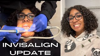 INVISALIGN 5 MONTH UPDATE  filing teeth pain level is invisalign worth it  invsalign review [upl. by Andel642]