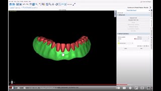 BlueSkyPlan 412 Copy Denture Create a teeth file and base file for printing [upl. by Arraeit958]