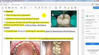 ENDODONTICS ll pulpal and periapical pathosis [upl. by Benedikt]