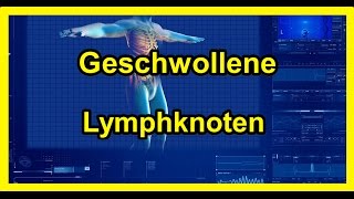 Geschwollene Lymphknoten  Vergrößerte Lymphknoten 2020 [upl. by Eseerehs]