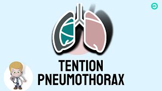 Tension Pneumothorax explained  USMLE [upl. by Colline971]