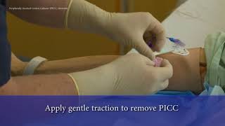 PICC Line Removal [upl. by Deedahs608]