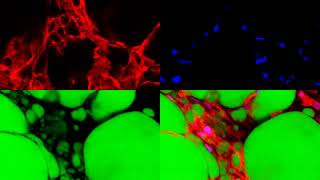 Innovative Technique Converts White Fat to Brown Fat [upl. by Irby412]