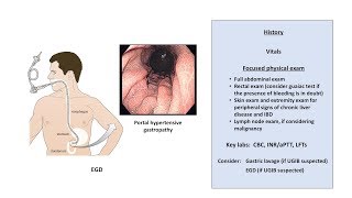 An Approach to GI Bleeding Melena Hematemesis Hematochezia [upl. by Tihw622]