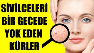 SİVİLCELERİ BİR GECEDE YOK EDEN KÜRLER [upl. by Nodla]