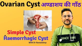 What is SIMPLE OVARIAN CYST amp HEMORRHAGIC OVARIAN CYST [upl. by Mahseh]