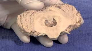 The Cerebellum Neuroanatomy Video Lab  Brain Dissections [upl. by Ahseela757]