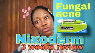 AffordableCheap way to get rid of fungal acneNixoderm for fungal acne forehead rashpimples [upl. by Vardon446]