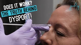 Watch the TRUTH Behind Dysport Wrinkle Relaxer at Juvly Aesthetics  Does it Work [upl. by Nahte786]