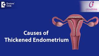 What causes Endometrial thickness  DrSmitha Sha of Cloudnine Hospitals  Doctors Circle [upl. by Enelrihs]