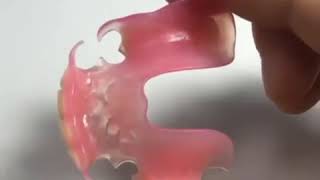 Valplast Flexible Denture [upl. by Callas250]