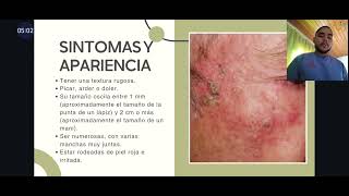 QUERATOSIS ACTÍNICA  Jorge Tamara  Rot 2524 DERMATOLOGÍA [upl. by Fionnula167]