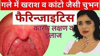 गले में सूजन  pharyngitis throat infection treatment in hindi  home remedies for sore throat [upl. by Sinnaoi]