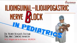 US GUIDED ILIOINGUINALILIOHIPOGASTRIC NERVE BLOCK [upl. by Namya]