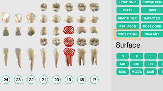 Dental Assisting  Patient Exam [upl. by Normac85]