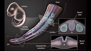 Differentiation of the somites [upl. by Paulo237]