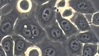 Microscope Imaging Station cancer cells behaving badly sub ITA [upl. by Minabe431]