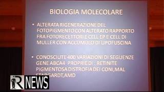 AGLIÈ  DOTT GIUSEPPE DE MARIE OCULISTA OSPEDALE DI IVREA E REFERENTE DEL CRV ASL TO4 [upl. by Atnahsal]