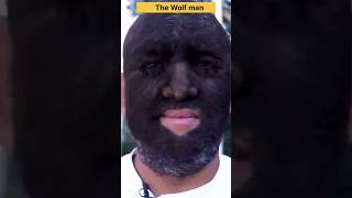 The most hairy man on EARTH 🌎shorts facts factswinhindi factshorts viralfacts story [upl. by Teriann683]