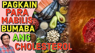 Pagkain Para Mabilis Bumaba ang Cholesterol  Payo ni Doc Willie Ong [upl. by Umont432]