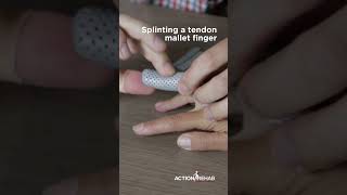 Mallet finger splint demo [upl. by Alex]