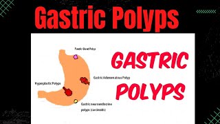 Lecture 17 Gastric Polyps GI Pathology 🔥Best Medical Channel Gastric Polyps GIT polyps [upl. by Leontina]