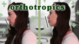 I Tried Orthotropics and Now I Dont Need Jaw Surgery  Mewing [upl. by Adianez456]