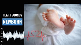 Newborn heart beat sound  How to calculate NB Heart rate  Normal NB Heart sound  Christina NP [upl. by Nagud]