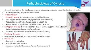 General Examination Cyanosis  Recognizing the Blue Tint  A Guide to Clinical Examination [upl. by Hunter409]