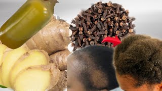 I used GINGER AND CLOVES in my hair then this happenedCLOVES and GINGER for Hair growth [upl. by Meave]