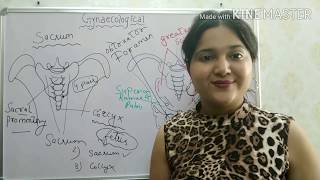 FEMALE PELVIS  GYNAECOLOGICAL NURSING EASY EXPLANATION [upl. by Delinda]