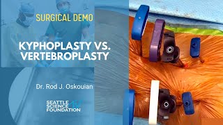 Kyphoplasty vs Vertebroplasty  Rod J Oskouian Jr  MD [upl. by Yruy]