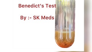 Benedict’s test for Reducing sugar monosaccharide neet Biology Ol Carbohydrate shorts [upl. by Wootten427]