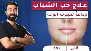 تخلص من حب الشباب وحبوب الوجه بأسرع طريقة  علاج حب الشباب في 5 أيام فقط [upl. by Claman188]