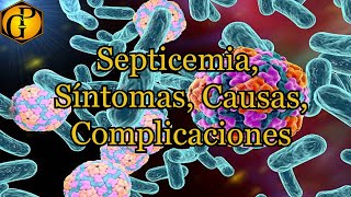 Septicemia Síntomas Causas Complicaciones [upl. by Daph]