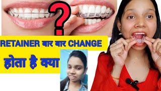 Retainer बार बार change होता है क्या 😇 braces bracesoff retainers beforeandafterbraces [upl. by Darryn]