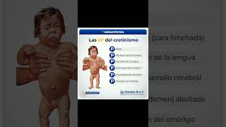 Cretinismo medicina [upl. by Dare]