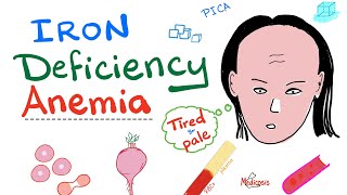 Iron deficiency without anemia vs Iron deficiency with anemia [upl. by Htebezile]