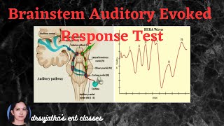 210Brainstem Evoked Response Audiometry BERA Part 22 bera oae screening [upl. by Laurene312]