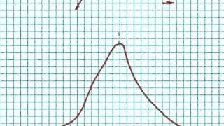 Using zscores to Calculate Percentiles [upl. by Amyas767]