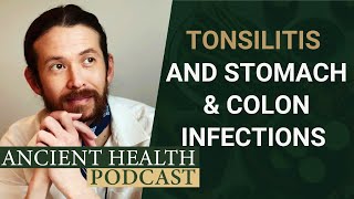 Chronic Tonsillitis and Its Relationship to Hidden Stomach and Colon Infections [upl. by Eduard]