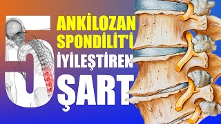 Ankilozan Spondiliti İyileştiren 5 Şart iyileş ankilozan [upl. by Anaes893]