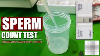 Sperm Count Lab Test  Semen Analysis  Complete video tutorial  Under Microscope [upl. by Acilgna]