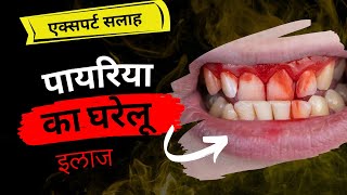 पायरिया का घरेलू इलाज  Pyorrhoea home remedies for you [upl. by Gillie742]